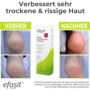 Produktbild für Hornhautentferner efasit Anti-Hornhaut Creme