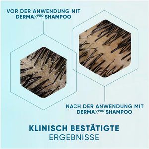 Produktbild für Shampoo Head&amp;Shoulders DermaXPRO Feuchtigkeit Anti-Schuppen