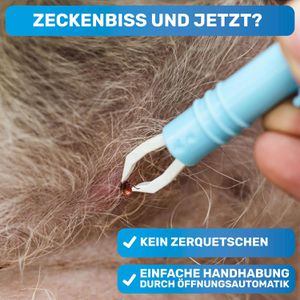 Produktbild für Zeckenzange BluePet Tick Tweezer, 2 Stück