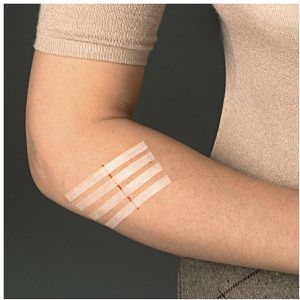 Produktbild für Wundnahtstreifen Lifemed steril, 10 Streifen