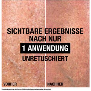 Produktbild für Bodylotion Neutrogena Intense Repair