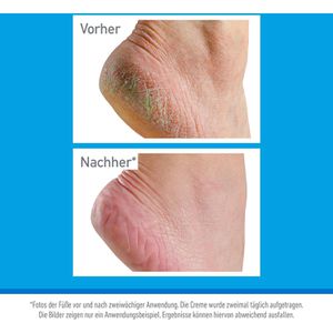 Produktbild für Fußcreme OKeeffes Healthy Feet, feuchtigkeitsspendend