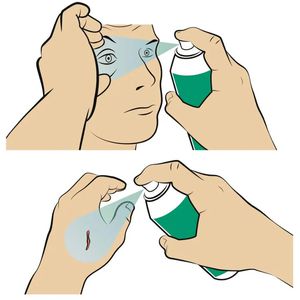 Produktbild für Wundspray Wero Wund- und Augenspray, Kinder &amp; Erwachsene 100ml