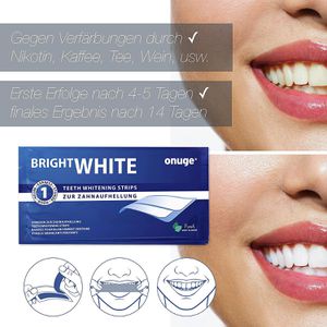Produktbild für Zahnaufhellung Onuge Bright White, ohne Peroxid