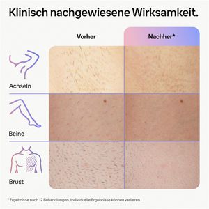 Produktbild für IPL-Haarentfernung Braun Skin i-expert 7, PL7147