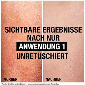 Produktbild für Bodylotion Neutrogena Deep Moisture Sensitive