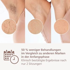 Produktbild für IPL-Haarentfernung Philips Lumea Series 9900 SkinAI, BRI973/00