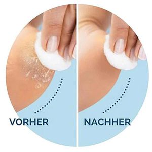 Produktbild für Ersatzrollen Scholl ExpertCare, für die Ferse