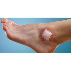 Produktbild für Pflaster Smith&amp;Nephew ALLEVYN Lite, 10 Strips