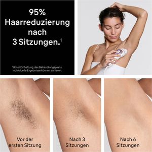 Produktbild für IPL-Haarentfernung Braun Skin i-expert 7, PL7432