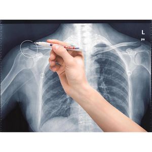 Produktbild für Röntgenmarker Edding 8010, weiß